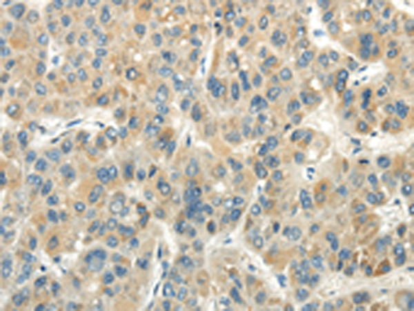 Rabbit Polyclonal Antibody to CHGB