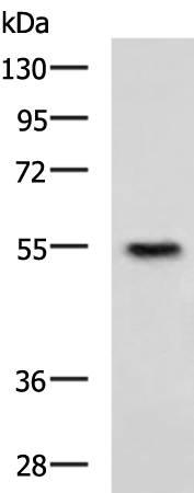 Rabbit Polyclonal Antibody to CHEK1