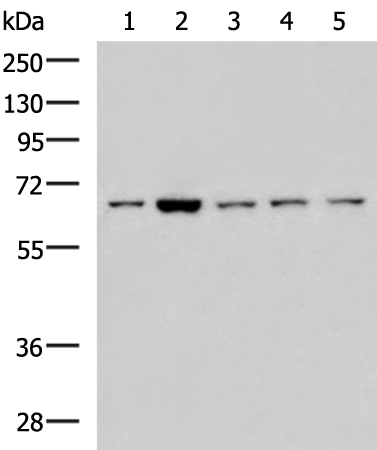 Rabbit Polyclonal Antibody to CHEK2