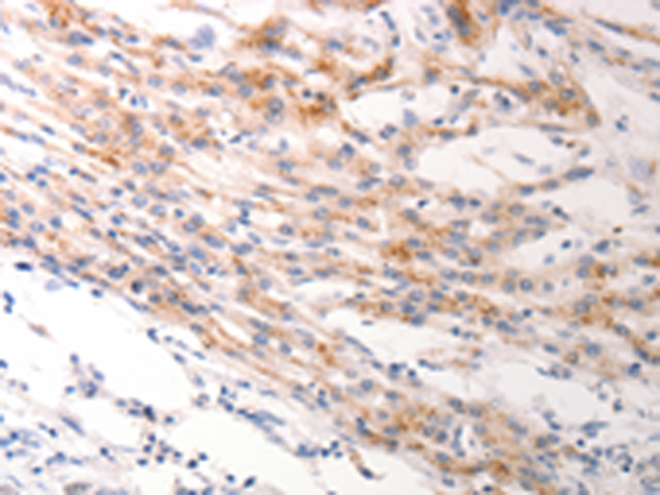 Rabbit Polyclonal Antibody to KRT6A/KRT6B/KRT6C