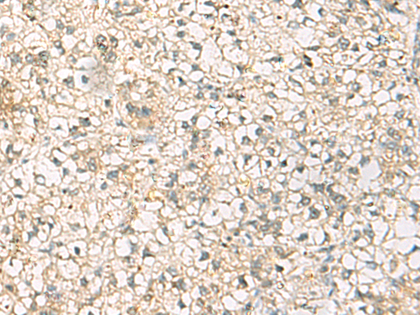 Rabbit Polyclonal Antibody to CMTM1