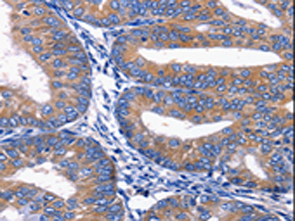 Rabbit Polyclonal Antibody to PLEKHO1