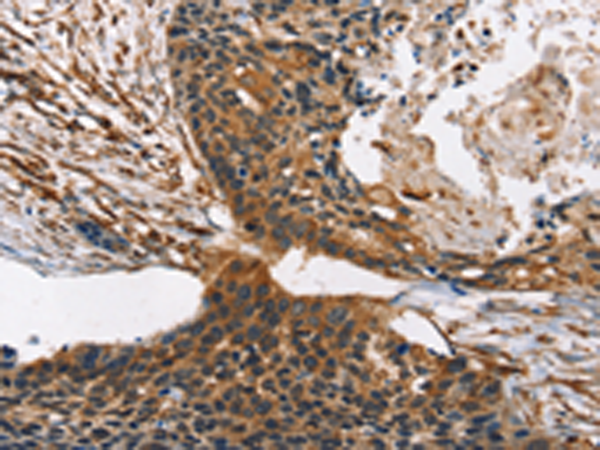 Rabbit Polyclonal Antibody to CNGA1