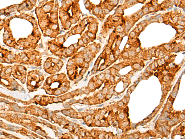 Rabbit Polyclonal Antibody to CNR1