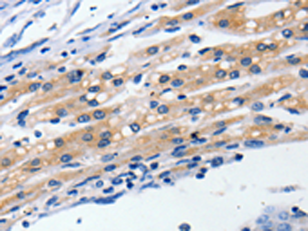 Rabbit Polyclonal Antibody to CLDN5