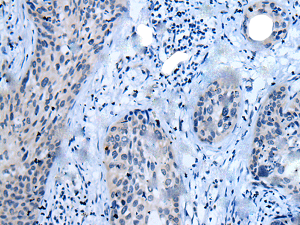 Rabbit Polyclonal Antibody to CLDN18