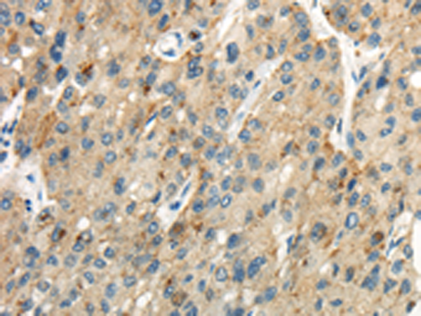 Rabbit Polyclonal Antibody to CLDN19