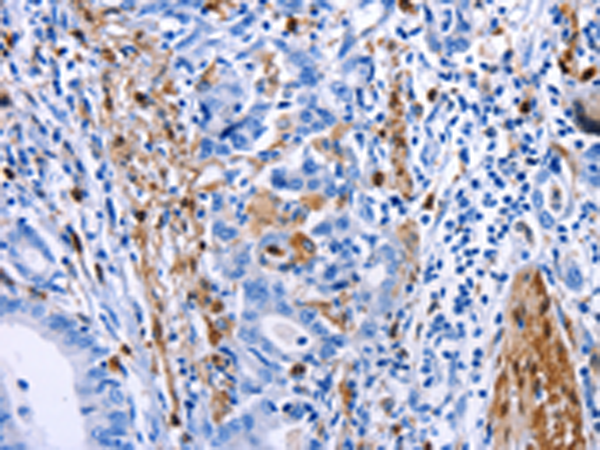 Rabbit Polyclonal Antibody to PTGS1