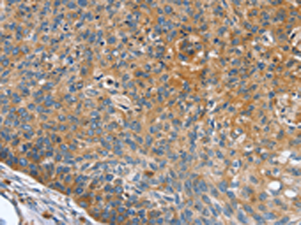 Rabbit Polyclonal Antibody to INS