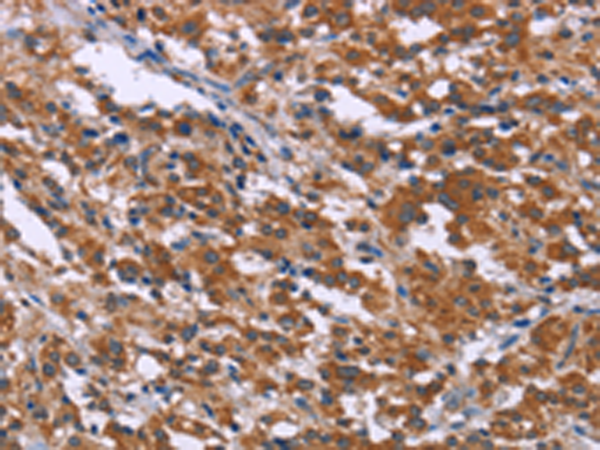 Rabbit Polyclonal Antibody to SKI