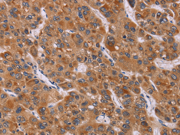 Rabbit Polyclonal Antibody to CALCA/CALCB