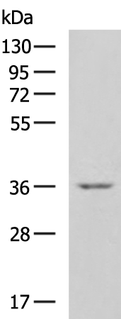 Rabbit Polyclonal Antibody to CCN2