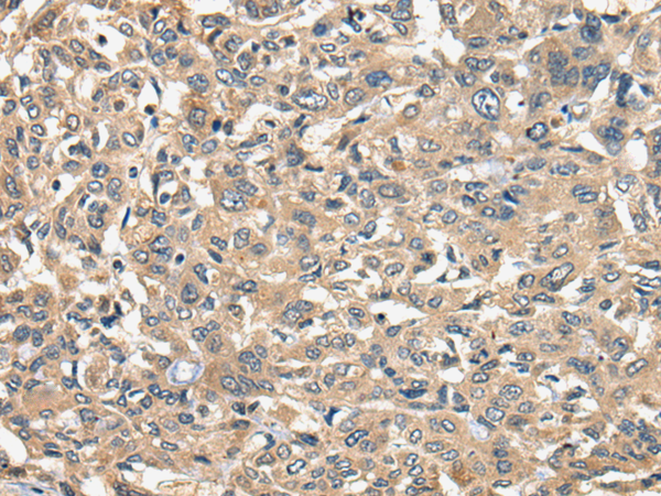 Rabbit Polyclonal Antibody to CTLA4