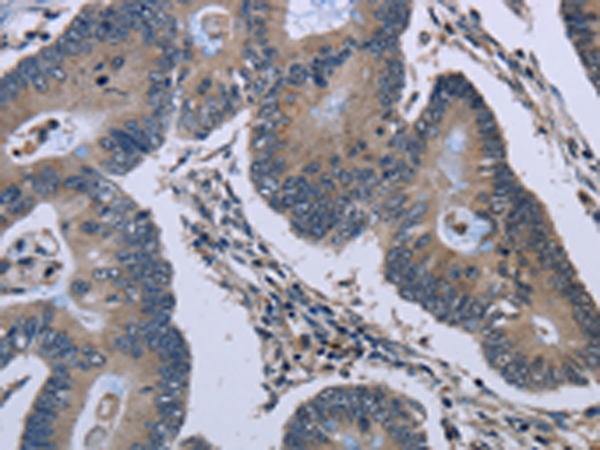 Rabbit Polyclonal Antibody to GJC2
