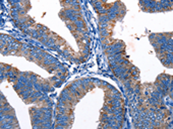 Rabbit Polyclonal Antibody to Gjc3