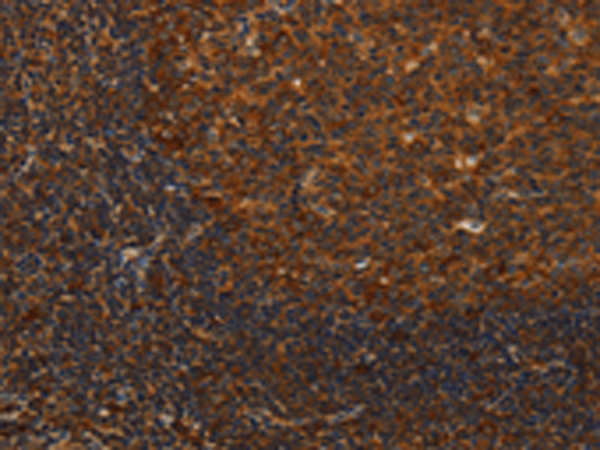 Rabbit Polyclonal Antibody to MIP