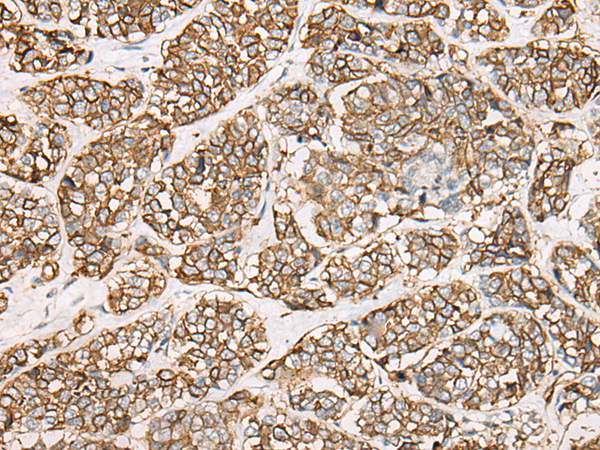 Rabbit Polyclonal Antibody to AQP1