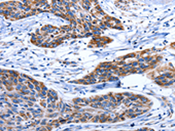Rabbit Polyclonal Antibody to AQP8