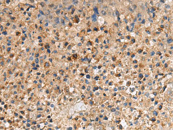 Rabbit Polyclonal Antibody to CXCR5