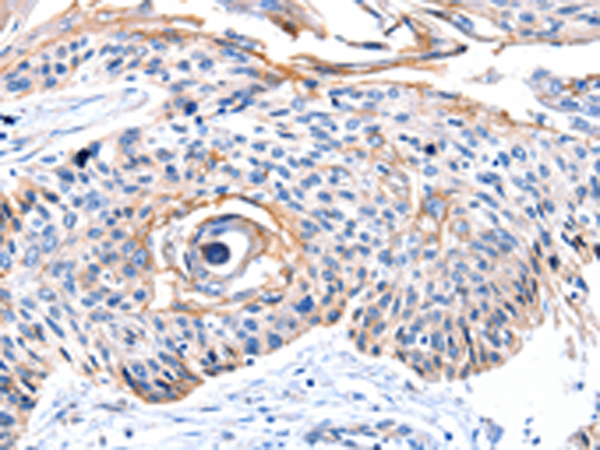 Rabbit Polyclonal Antibody to CCNB2