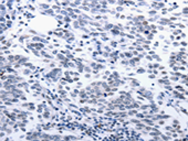 Rabbit Polyclonal Antibody to CCND1