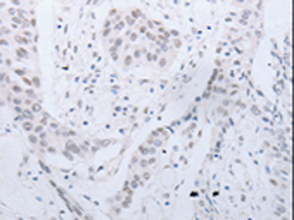 Rabbit Polyclonal Antibody to CCND2