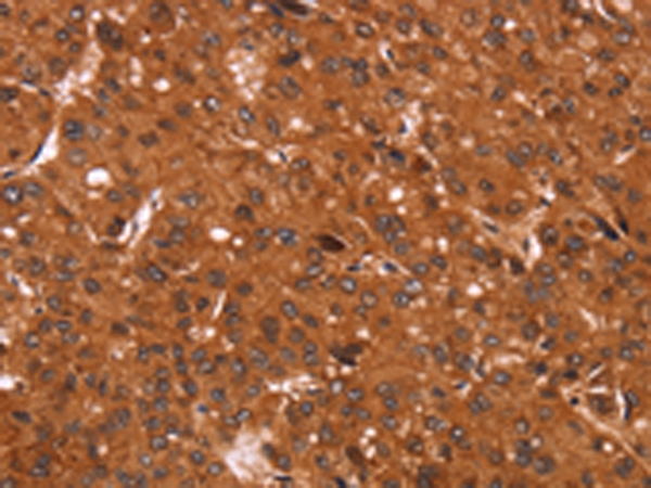 Rabbit Polyclonal Antibody to CCND3
