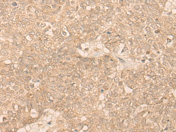 Rabbit Polyclonal Antibody to CCNE1