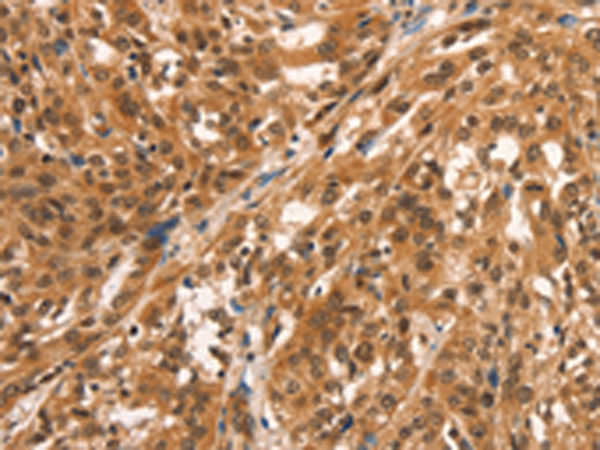 Rabbit Polyclonal Antibody to CCNE2
