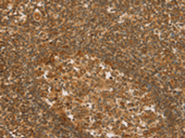 Rabbit Polyclonal Antibody to SLC6A3