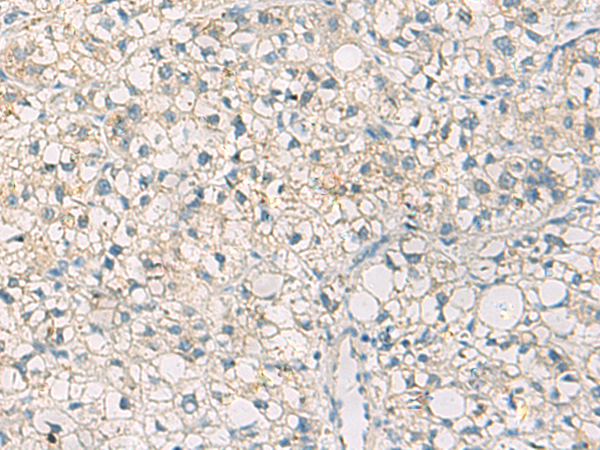 Rabbit Polyclonal Antibody to LY75