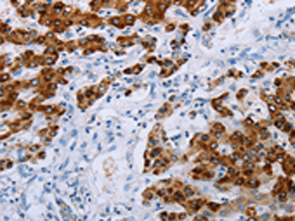 Rabbit Polyclonal Antibody to NDUFA12