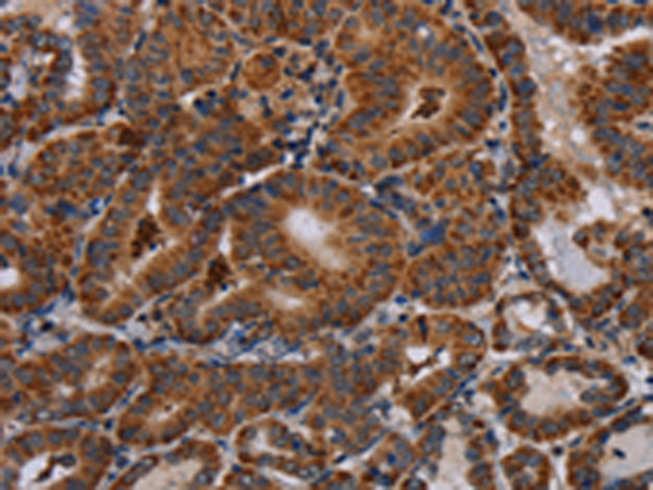 Rabbit Polyclonal Antibody to DISC1