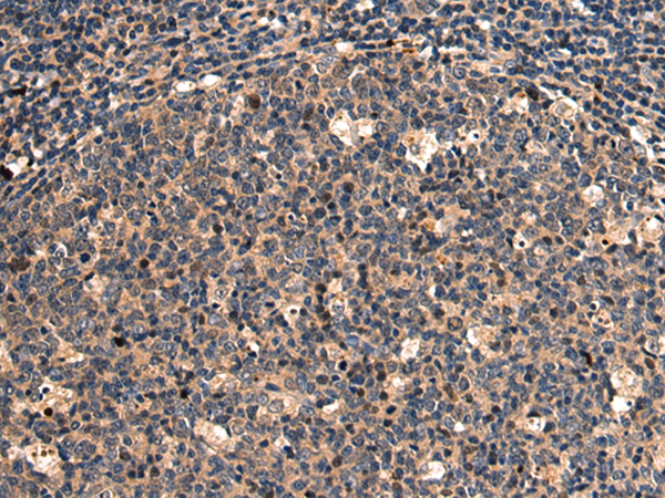 Rabbit Polyclonal Antibody to DMBT1