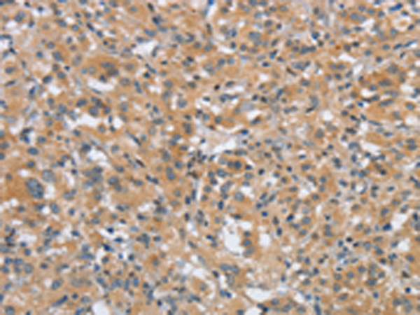 Rabbit Polyclonal Antibody to DTNBP1