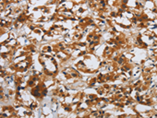 Rabbit Polyclonal Antibody to DSP