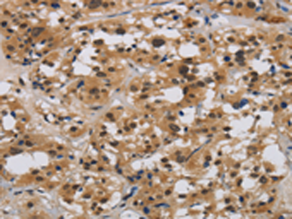 Rabbit Polyclonal Antibody to E2F4