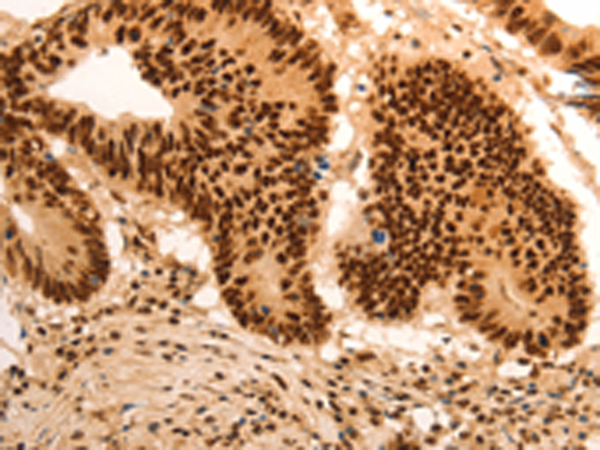 Rabbit Polyclonal Antibody to E2F7