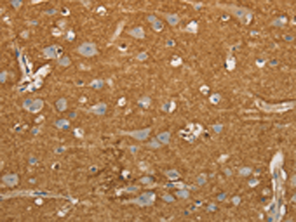 Rabbit Polyclonal Antibody to SLC1A2