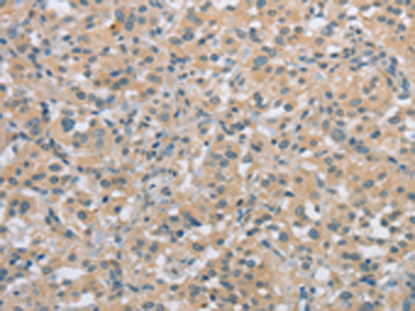 Rabbit Polyclonal Antibody to ECRG4