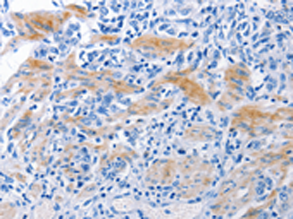 Rabbit Polyclonal Antibody to NECTIN1
