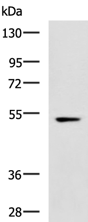 Rabbit Polyclonal Antibody to EDNRB