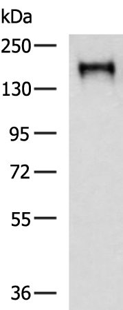 Rabbit Polyclonal Antibody to EGFR