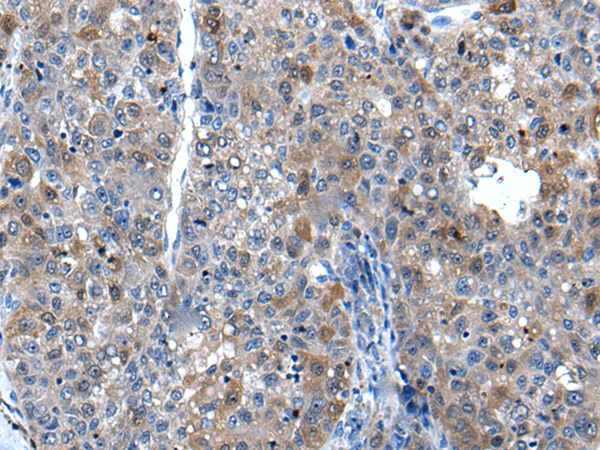 Rabbit Polyclonal Antibody to SFRP1