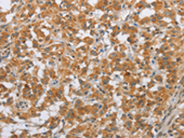 Rabbit Polyclonal Antibody to SFRP5