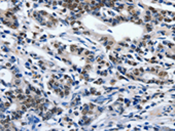 Rabbit Polyclonal Antibody to ENPP3