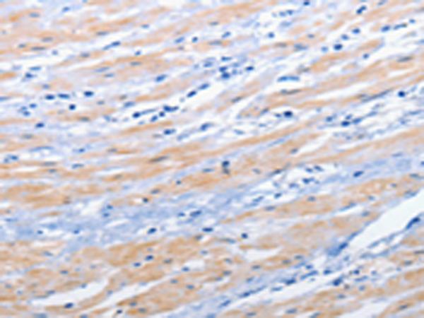 Rabbit Polyclonal Antibody to EPHA1
