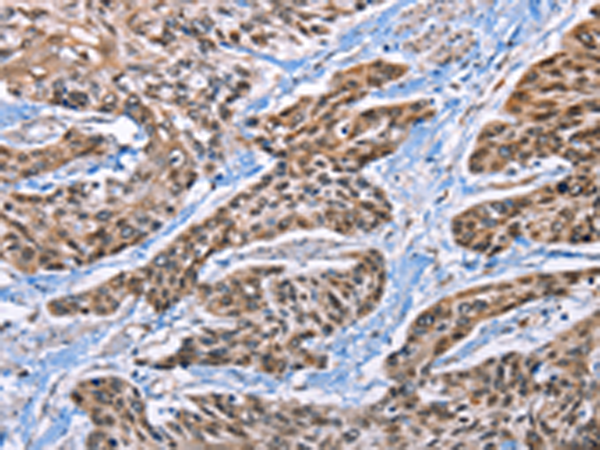 Rabbit Polyclonal Antibody to EPHA4
