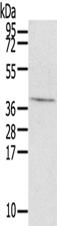 Rabbit Polyclonal Antibody to EFNB3