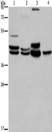 Rabbit Polyclonal Antibody to MAPK1/MAPK3